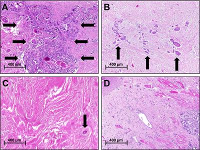 Neoadjuvant Chemoradiotherapy for Oral Cavity Cancer: Predictive Factors for Response and Interim Analysis of the Prospective INVERT-Trial